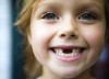 Почему выпадают молочные зубы?
